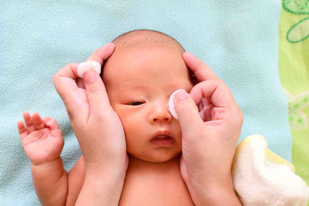 Cara Mengatasi Mata Bayi Berair
