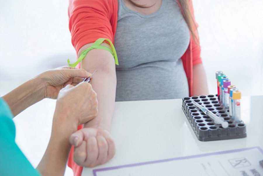 Jenis dan Manfaat Tes Darah Selama Masa Kehamilan