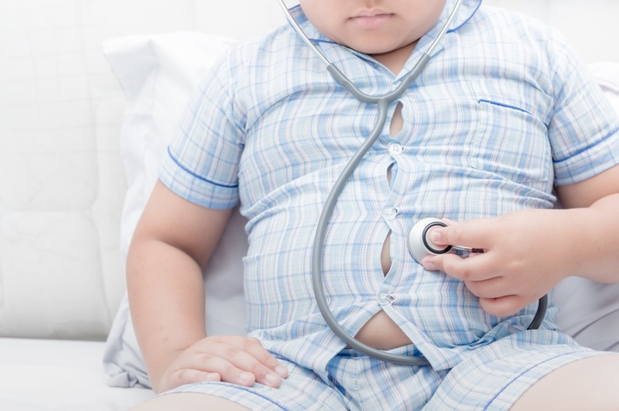 3 Penyebab Obesitas pada Anak dan Cara Menanganinya