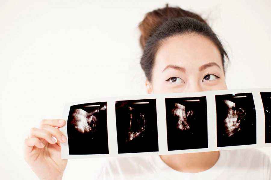 Seberapa Penting Rutin Melakukan USG Saat Hamil?