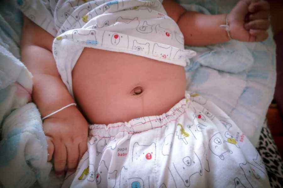 10 Penyebab Perut Kembung pada Anak Ini Perlu Diwaspadai