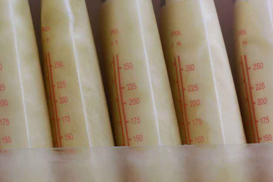 Bayi Kuning, Bolehkah Ibu Menyusui? Simak Faktanya!