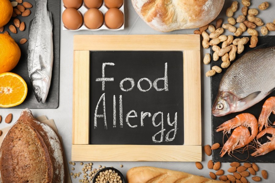 Alergi Makanan: Gejala, Penyebab, Hingga Cara Mengatasi
