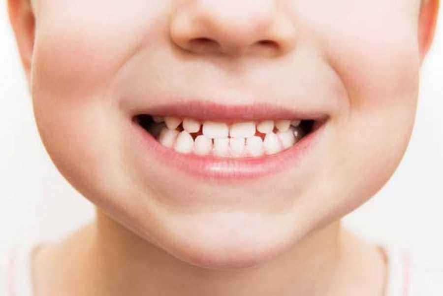 Pertumbuhan, Masalah, & Cara Merawat Gigi Susu si Kecil