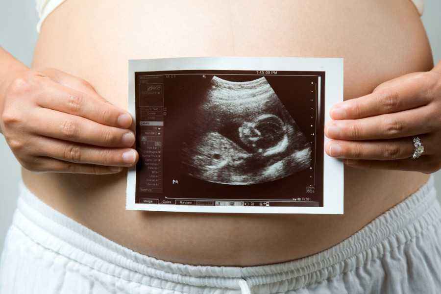 3 Cara Tingkatkan Pertumbuhan Tulang Bayi di Kandungan