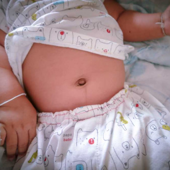 10 Penyebab Perut Kembung pada Anak Ini Perlu Diwaspadai