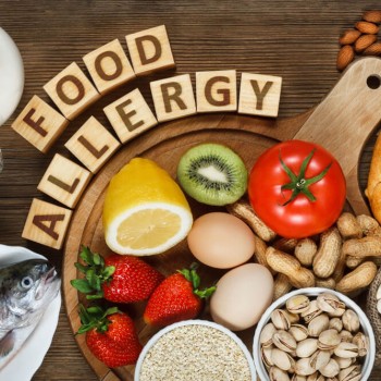3 Cara Aman dan Efektif Atasi Alergi Makanan pada Si Kecil