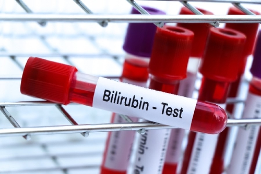 Kadar Bilirubin Normal Bayi yang Perlu Ibu Ketahui